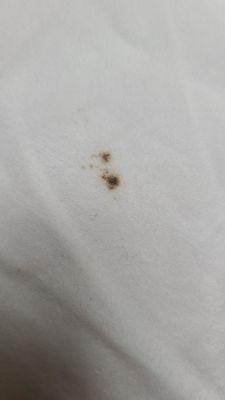 Mold on the pillow.