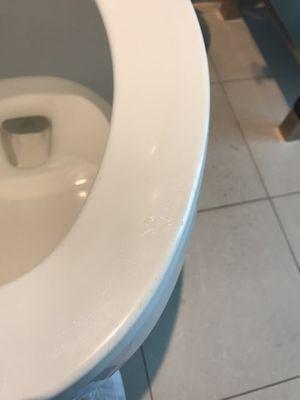 Plastic peeling on toilet seat (uncomfortable and sticky seat)