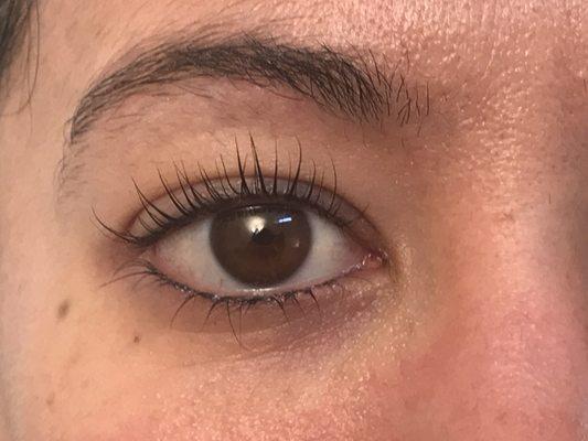 After Lashlift