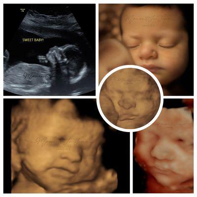 2D Ultrasound, 3D/4D Ultrasound, HD Ultrasound, 8K Enhancement