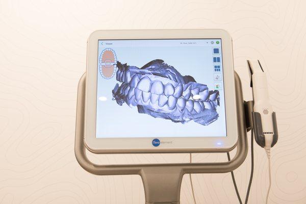 No dental putty here! Our iTero Element takes a 3D scan of your teeth.