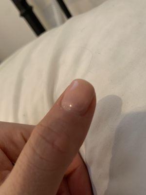 Fingernail with uneven polish