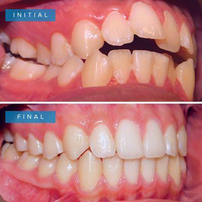 Before and after of our patient.