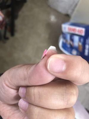 Part of my nail she ripped off.