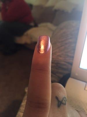 Uneven pinky nail