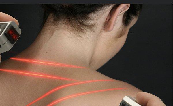 Cold laser treatments