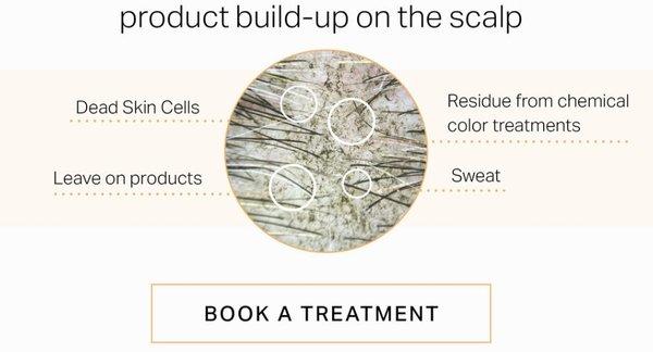 Scalp & Hair Treatment by HydraFacial