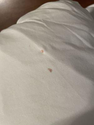 Blood on pillow