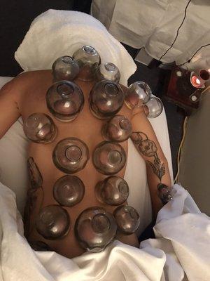 Body Feels relaxed under fire cupping treatment