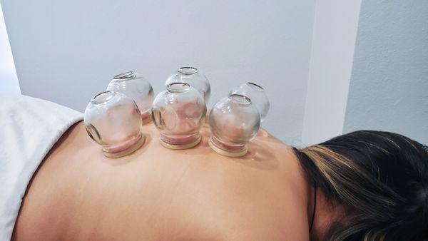 Cupping Treatment