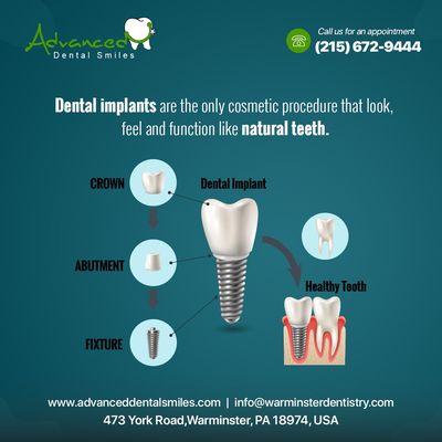 Dental Implants are the only cosmetic procedure that look, feel and function like natural teeth.