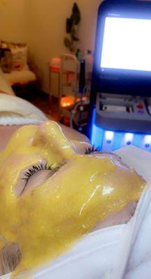 Hydrafacial with a hydro jelly mask....