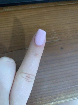 Very crooked nail