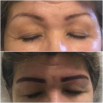 Microblading