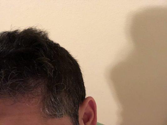 Terrible uneven patchy cut.