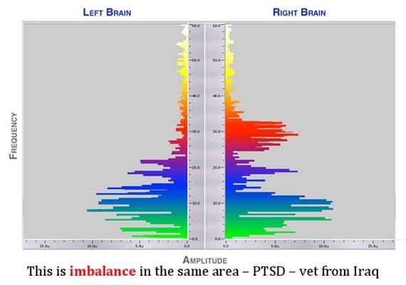 Brain Optimization takes care of the imbalance in the brain