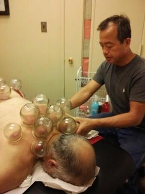 Cupping treatment for back pain