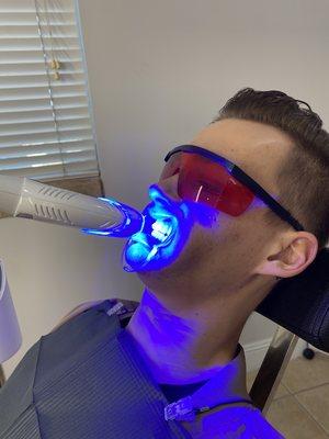 Teeth whitening