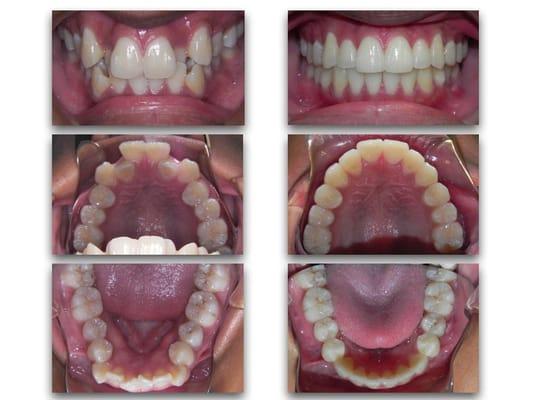 Dr. Pesh specializes in "smile transformations" like this one!