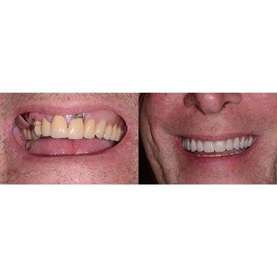 Pacific Northwest Prosthodontics