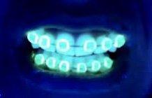 Glow-In-The-Dark Dental Braces