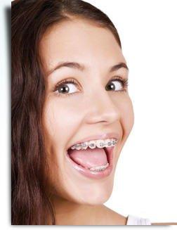 Orthodontics in Fort Worth, TX