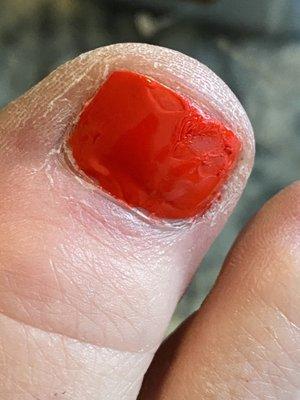 Gauges in nail polish on big toe. Bumpy application of polish. Didn't remove dry skin.