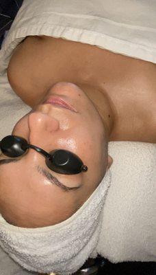 Hydrafacial glow