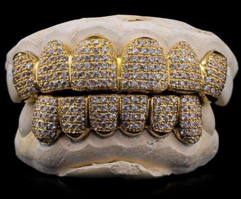 Custom Grillz