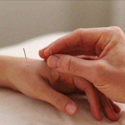 Gentle acupuncture to treat the body through the nervous system.