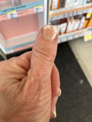 Chipped nail