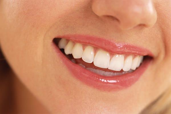 Our cosmetic dental work leads to better teeth and pretty smiles!