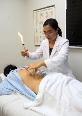 Dr. Li is performing cupping treatment