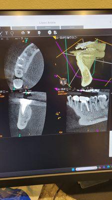 Tushar B Patel, DDS - Arrow Endodontics