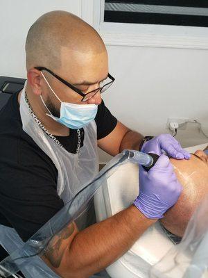 This is a noninvasive procedure to help with all forms of hair loss. This corrective procedure was performed in Puerto Rico by Eddie Lopez.