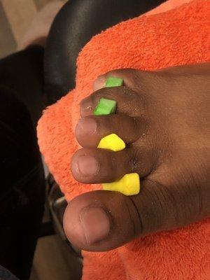 Acrylic toes application