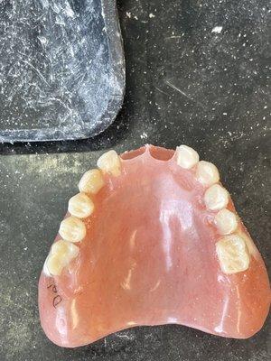 Denture Repair. Lost tooth