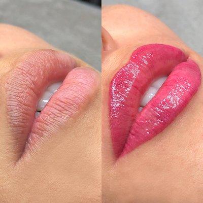 Lips Micropigmentation
Before and After