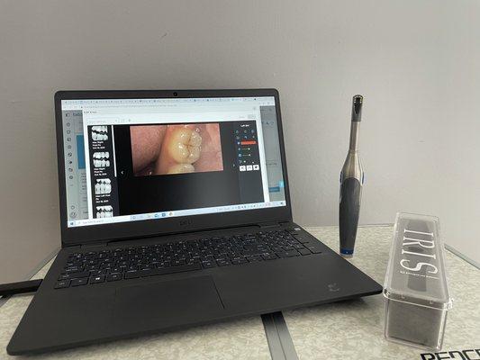 Crystal clear images are easily taken with our state of the art intraoral cameras