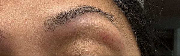 Swollen eyebrows and bruises and cuts from the threading today