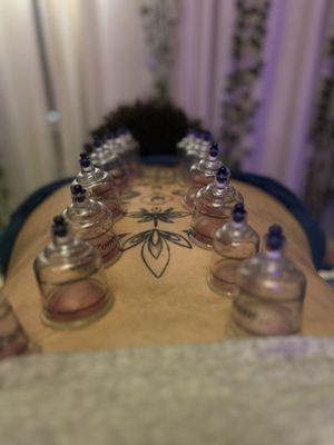 Cupping