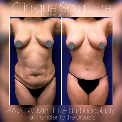 Clinique Sculpture