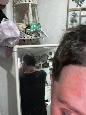 Hairline and haircut is trashed because of the barber!