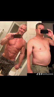 This is a before and after pic of what Dr Danny Smith did for me and this transformation only took several months! I'm mid 50's...