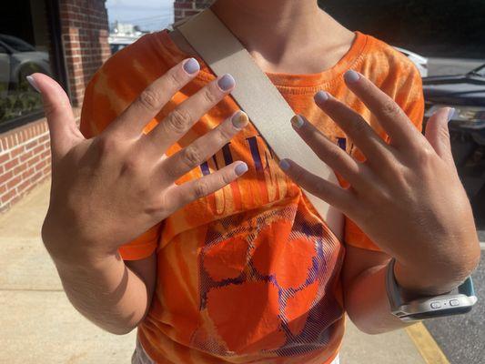 Dip manicure with pineapple art