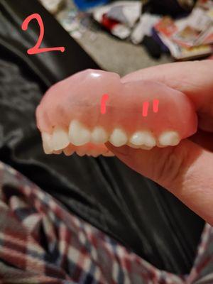 There's a small tooth then larger tooth then back to small tooth ... This is not how natural teeth look.