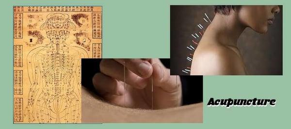 Railing Chiropractic & Acupuncture 13241 Bartram Park Blvd Jacksonville, FL 32258  Suite 509 http://railingchiropractic.com/