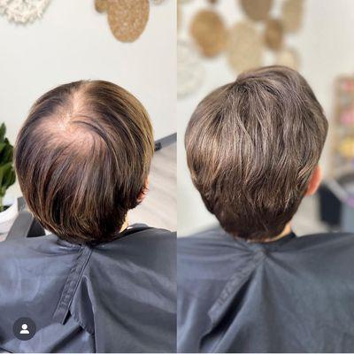 Hair topper before and after