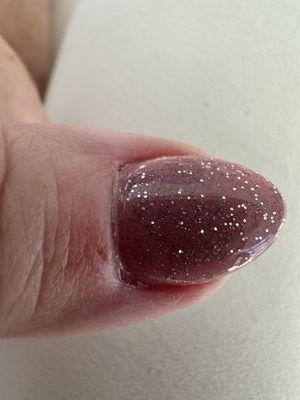 Thumb with cuts on cuticle and dip not done to edge.