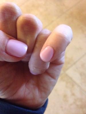 Pinky nail is basically an uneven blob. Sucks.